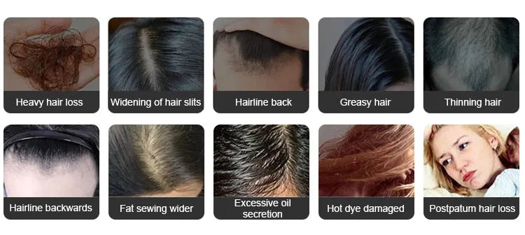 Lumin Hair Pro *Electric Laser Hair Growth Comb with Red Light Therapy*